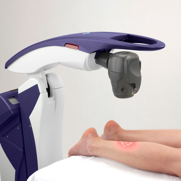 M6_Application_LowerLeg-optimized-1024x767